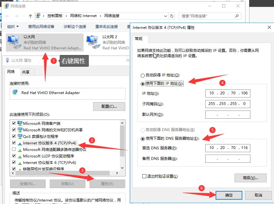 设置固定 IP 地址